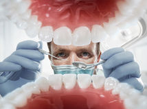 zub, zubár, stomatológ, chrup, ďasná, Parodontitída