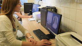 V žilinskej nemocnici sa museli vzbúriť, aby na oddelení pribudli lôžka