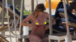 Slávna topmodelka hore bez a červená ako rak. Zabudla sa vari natrieť?