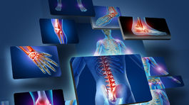 Bolesť kĺbov je častá a nepríjemná