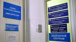 V kauze plastika už padajú hlavy