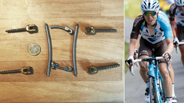 Zošrobovaný cyklista. Elitný pretekár sa pochválil skrutkami, ktoré nosil v tele