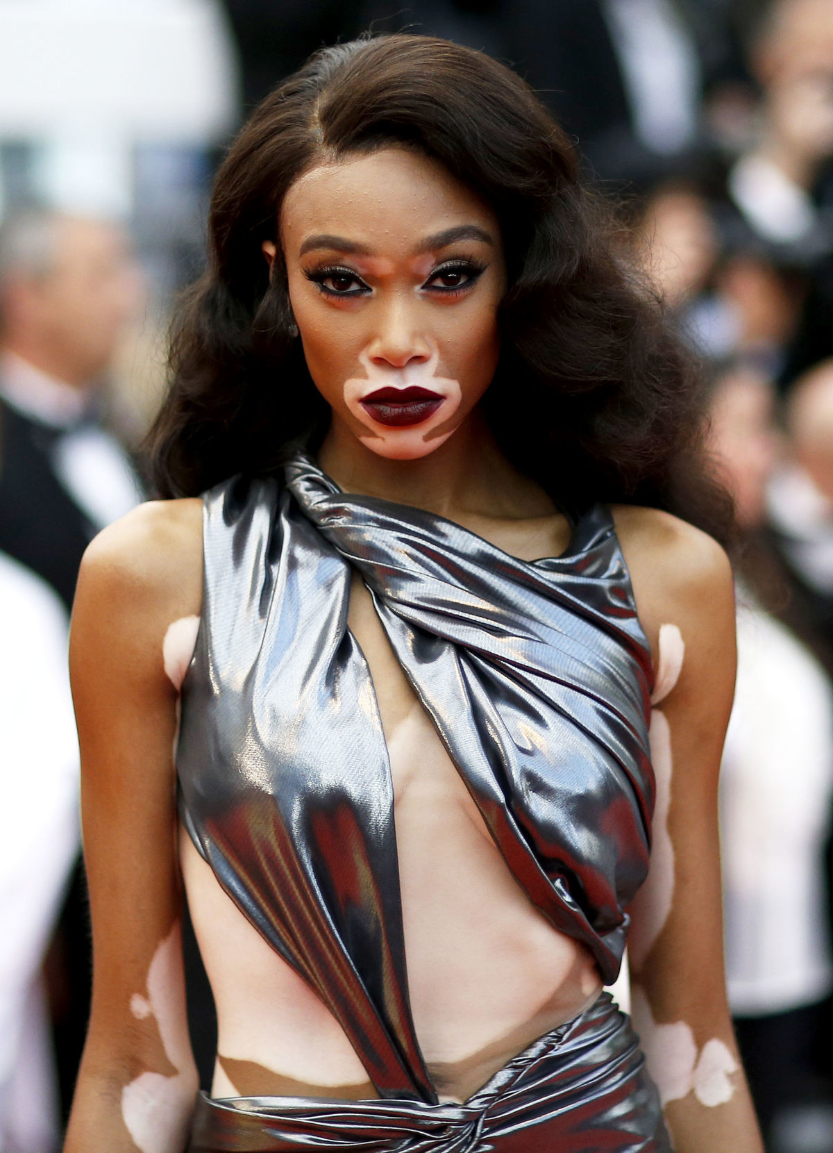 Modelka Winnie Harlow pózuje fotografom na...