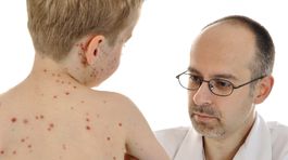 V Michalovciach ignorovali karanténu a pomohli tým osýpkam