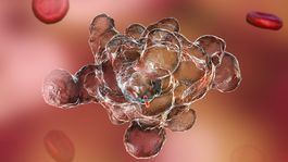 Ktoré infekcie najviac trápia seniorov?