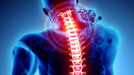 Bolesť chrbta nepodceňujte