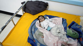 Búrka odhodlania arabskej koalície spôsobuje Jemenčanom genocídu