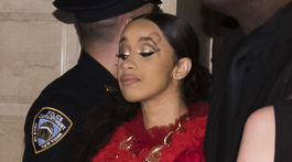 Raperka Cardi B s hrčou na hlave, ktorú jej vraj spôsobil ochrankár Nicki Minajovej. 