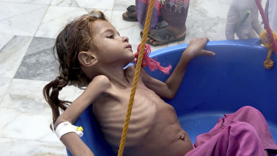 OSN posiela pomoc do časti Jemenu, kde ľudia jedia listy