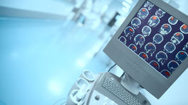 Sedem štádií Alzheimerovej choroby