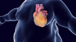 Strážte si hmotnosť. Nie kvôli postave, ale kvôli srdcu