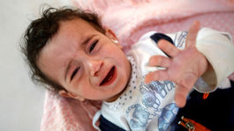 Jemen je podľa OSN na pokraji 'storočného' hladomoru