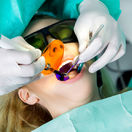 dentist, igiena dentara, sigilarea dintilor