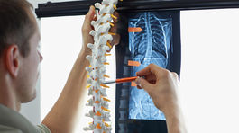 Najčastejšie dôvody bolesti chrbta a ako im môžeme predchádzať