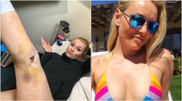 FOTO Vonnovej dôchodok: najskôr operácia, potom dúhové bikiny