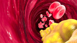 article thumbnail