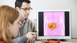 Žlčník: Prečo vzniká kolika?