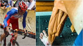 Ako z atlasu anatómie. Ďalší cyklista zverejnil snímku nohy v cieli