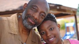 Pomahačov tím v USA transplantoval tvár prvému černochovi