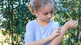 Atopický ekzém: Pri pokožke to nekončí