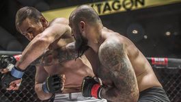 Rozpadnutá čeľusť a operácia. Hrdina Oktagonu: Budem rovnako pekný 