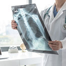 doktor, röntgenová snímka, pľúca