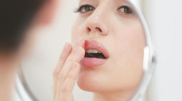 Nenahraditeľná aminokyselina: Lyzín bojuje proti herpesu