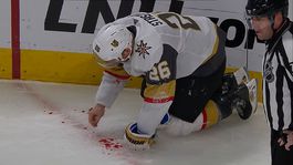 Stastny v krvavej potope hľadal zuby. Viac ho naštval Tatar 