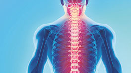 Ochorenia, ktoré ohrozujú chrbticu