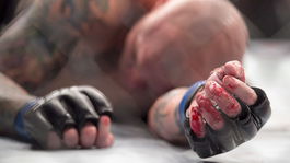 Hviezda MMA si chcela pre záchranu kariéry odrezať prst 
