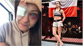 Na titul môže zabudnúť. Poľská kráska dostala poriadny výprask