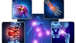 Čo nás bolí najčastejšie a v čom sú muži a ženy rozdielni?