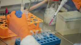 Rozhovor s mikrobiológom: Ako sa zisťuje koronavírus?