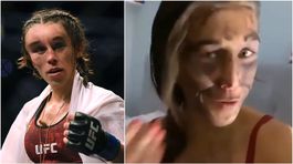 Hodiny plaču. Poľská hrdinka ukázala modriny zo strašidelného zranenia