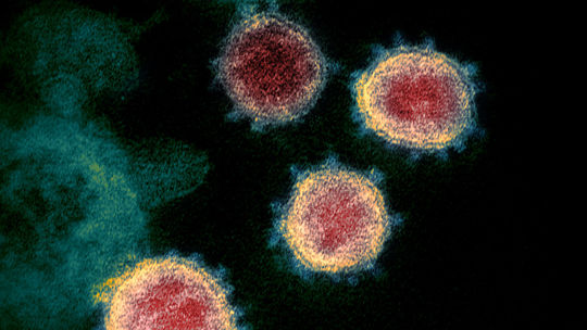 Na Slovensku pribudlo 41 nových prípadov nákazy koronavírusom