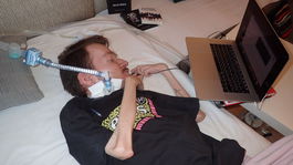 Nehybný Michal s tracheostómiou: Som doma celé mesiace. Dá sa to zvládnuť!