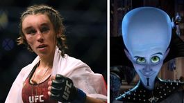 Vtipy s hematómom ju pobavili: Ale dva dni som nevidela na ľavé oko!