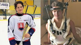 Americký sen pribrzdil náraz od kamaráta. Mohol ochrnúť i zomrieť