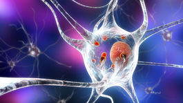 Čo treba vedieť o Parkinsonovej chorobe