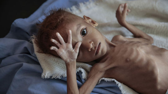 Pandémia môže spôsobiť hladomor. OSN žiada 6,7 miliardy dolárov