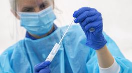 Súťaž v Česku je ohrozená. Mladá Boleslav hlási prvý prípad nákazy