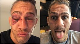 Pokropený živou vodou. Bitkár z UFC ukázal zázračné uzdravenie