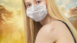 Nádor kože melanóm. Ktoré typy sú najagresívnejšie?