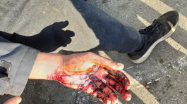 Amnesty International tvrdí, že Chorváti mučia migrantov. Tí to odmietajú