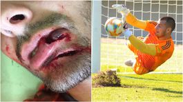 Spodná pera na franforce. Rusov ukázal hororové zranenie