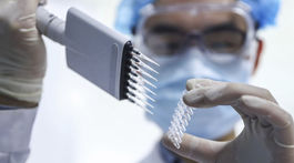 Na Slovensku pribudlo 80 nových prípadov Covidu-19, urobili 3 435 testov