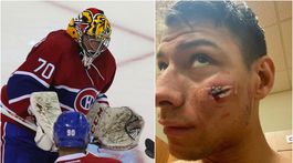 Tatar sa prizeral strašidelnému momentu. Po delovke Webera zaliala brankára krv