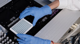 Na Slovensku pribudlo 121 prípadov infekcie koronavírusom