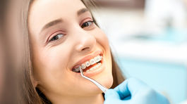 Union bude prispievať na zubné strojčeky