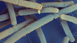 Slovenskí a českí vedci popísali jav, ku ktorému dochádza pri smrti bakteriálnej bunky